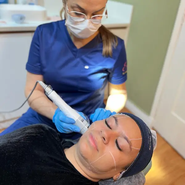 Profissional aplicando procedimento facial em paciente com marcacoes de planejamento no rosto
