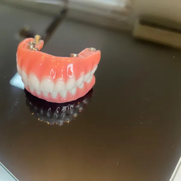 Protese total tipo protocolo, com os cilindros metalicos aparentes, apoiada sobre uma mesa de vidro preto com reflexo