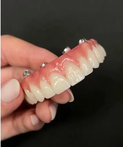 Mão segurando uma prótese dentária sobre implantes, feita na Humanized